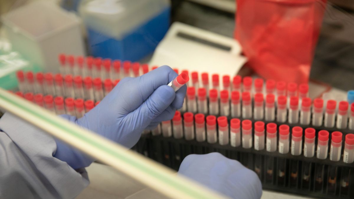 Les actions françaises liées au coronavirus ont bondi de plus de 500% depuis janvier